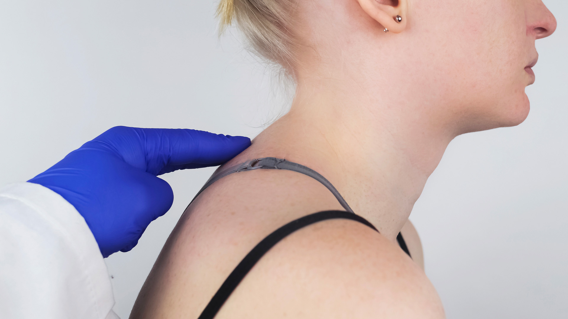 Липосакция вдовьего горбика. Симптомы холки. Холка горб вдовий горбик. Холка вдовий горбик психосоматика. Симптомы холки.
